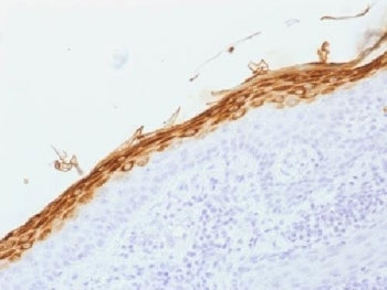 Filaggrin Antibody