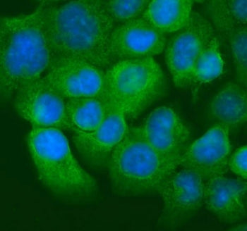 Immunofluorescent staining of FFPE human A431 cells with Keratin 20 antibody (green) and DAPI nuclea