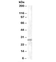 Western blot testing of K562 lysate with CHMP5 antibody at 1ug/ml. Predicted molecular weight: ~25kD