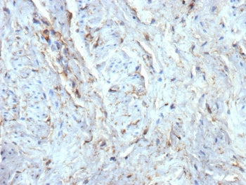 IHC staining of FFPE human uterus tissue with recombinant CD34 antibody (clone rICO-115). HIER: boil