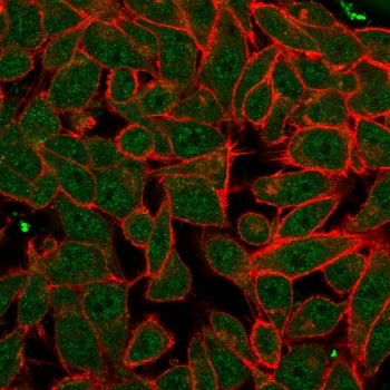 Immunofluorescent staining of PFA-fixed human HeLa cells using Pancreas/duodenum homeobox protein 1 