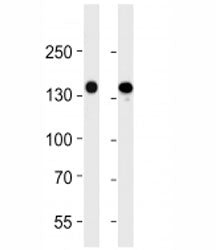 VEGFR3 Antibody