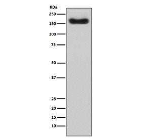 Western blot testing of human plasma lysate with Complement Factor H antibody. Predicted molecular w