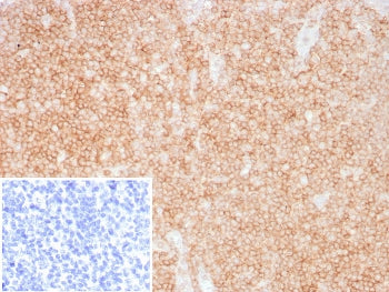 CD48 Antibody (Pan Leukocyte Marker)