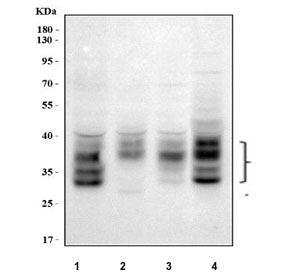 Western blot testing of human 1) HeLa, 2) HepG2, 3) 293T and 4) Caco-2 cell lysate with PZR antibody