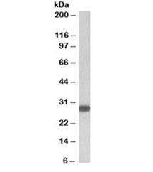 Western blot testing of human thyroid gland lysate with TSHR antibody at 0.5ug/ml. Predicted molecul