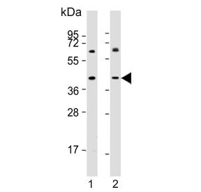 Western blot testing of human 1) LNCaP and 2) MDA-MB-231 cell lysate with LGASLS8 antibody. Expected
