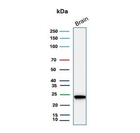 Western blot testing of human brain tissue lysate with PGP9.5 antibody. Predicted molecular weight ~