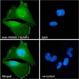 IF/ICC staining of fixed and permeabilized human U-251 cells with PRDM11 antibody (green) at 10ug/ml