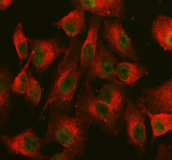 Immunofluorescent staining of NCOA6 using anti-NCOA6 antibody (green) and anti-Beta Tubulin antibody