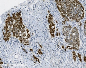 PTBP2 Antibody