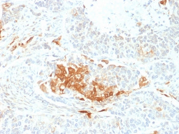 NSE Antibody / Neuron Specific Enolase