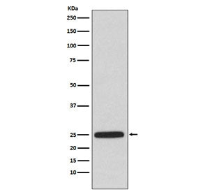 Western blot testing of human A549 cell lysate with HPRT antibody. Predicted molecular weight ~24 kD