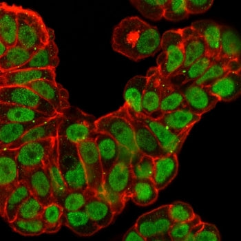 Immunofluorescent staining of PFA-fixed human MCF7 cells with recombinant FOXA1 antibody (clone FOXA
