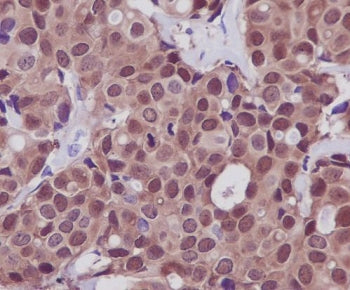 IHC staining of FFPE human breast tissue with HSP70 antibody. HIER: boil tissue sections in pH6, 10m