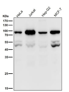 Western blot testing of human samples using the PSIP1 antibody at 1:1000 dilution for 1 hour at room