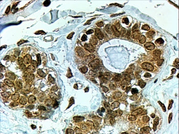 IHC testing of FFPE human breast with CYP7B1 antibody at 4ug/ml. HIER: steamed with pH6 citrate buff