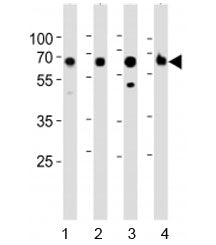 ACSM5 Antibody