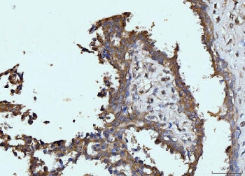 Glutaminase Antibody / GLS