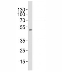 Aurora-A Antibody (AURKA)