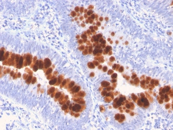 IHC staining of FFPE human colon with Fas antibody. HIER: boil tissue sections in pH 9 10mM Tris wit