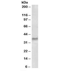 Western blot testing of human tonsil lysate with GCH1 antibody at 0.5ug/ml. Predicted molecular weig