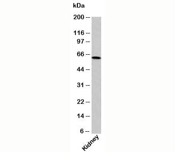 Western blot testing of human samples with OTUD5 antibody at 2ug/ml.