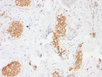 IHC testing of human bladder with GLUT1 antibody (clone GLUT1/2476). Required HIER: boil tissue sect