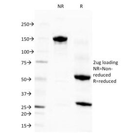 Eosinophil Peroxidase Antibody