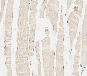 IHC testing of FFPE human skeletal muscle tissue with Glucosylceramidase beta antibody. HIER: steam 