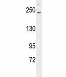 RICTOR antibody western blot analysis in mouse bladder tissue lysate. Predicted molecular weight ~20