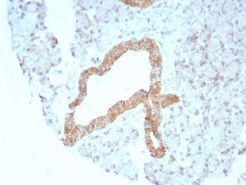 IHC staining of FFPE human prostate tissue with recombinant CD269 antibody (clone rCD269/8507). HIER