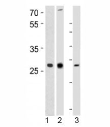 Western blot analysis of 1) human CEM, 2) rat PC-12, and 3) mouse spleen tissue lysate using LIF ant