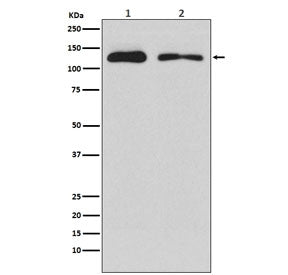 Western blot testing of 1) human HEK293 and 2) rat PC-12 cell lysate with ULK1 antibody. Predicted m