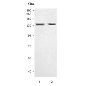 Niemann Pick C1 Antibody / NPC1