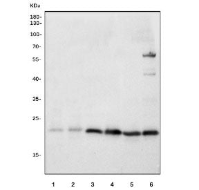 Western blot testing of 1) rat thymus, 2) rat PC-12, 3) mouse brain, 4) mouse spleen, 5) mouse thymu