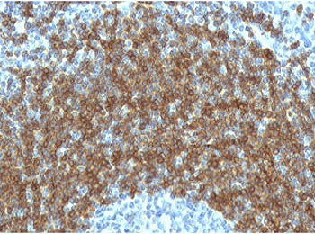 CD79b Antibody