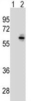 Western blot analysis of CDC25C antibody and 293 cell lysate (2 ug/lane) either nontransfected (Lane