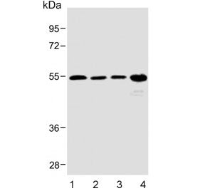 Western blot testing of human 1) heart, 2) kidney, 3) skeletal muscle and 4) SK-BR-3 lysate with SPN