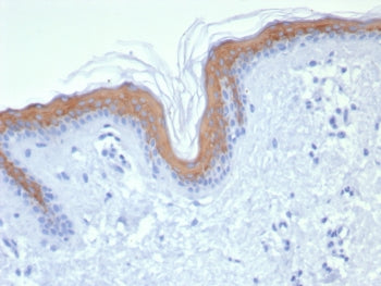 IHC staining of FFPE human skin tissue with Cytokeratin 1 antibody (clone KRT1/8342R). HIER: boil ti