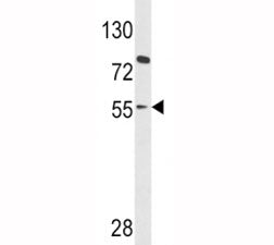 Western blot analysis of PAX8 antibody and HL-60 lysate. Predicted molecular weight ~48kDa but also 
