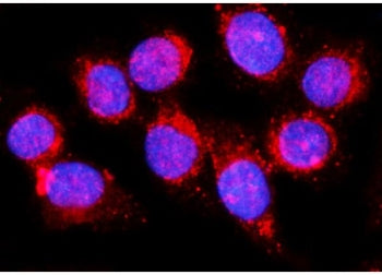 Immunofluorescent staining of FFPE human SiHa cells with PAST1 antibody (red) and DAPI nuclear stain