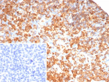 IHC staining of FFPE human tonsil tissue with SHP-1 antibody (clone PTPN6/7544). Inset: PBS used in 