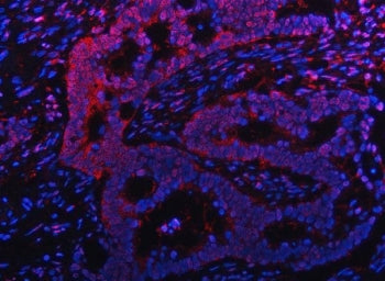 PSMB9 Antibody / Proteasome subunit beta type 9