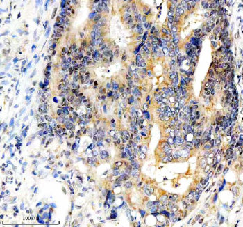 Immunohistochemical staining of FBXO7 using anti-FBXO7 antibody. FBXO7 was detected in a paraffin-em
