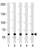 FOXP1 Antibody