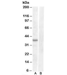 Western blot testing of mouse kidney lysate with ASNA1 antibody at 1ug/ml with [B] and without [A] b