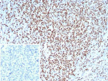 LEF1 Antibody / Lymphoid enhancer-binding factor 1 / TCF1 alpha
