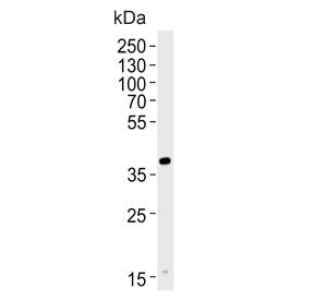 Western blot testing of human HL60 cell lysate with Haptoglobin-related protein antibody. Predicted 