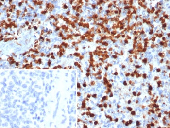 IHC staining of FFPE human spleen tissue with Calprotectin antibody (clone S100A9/7548). Inset: PBS 